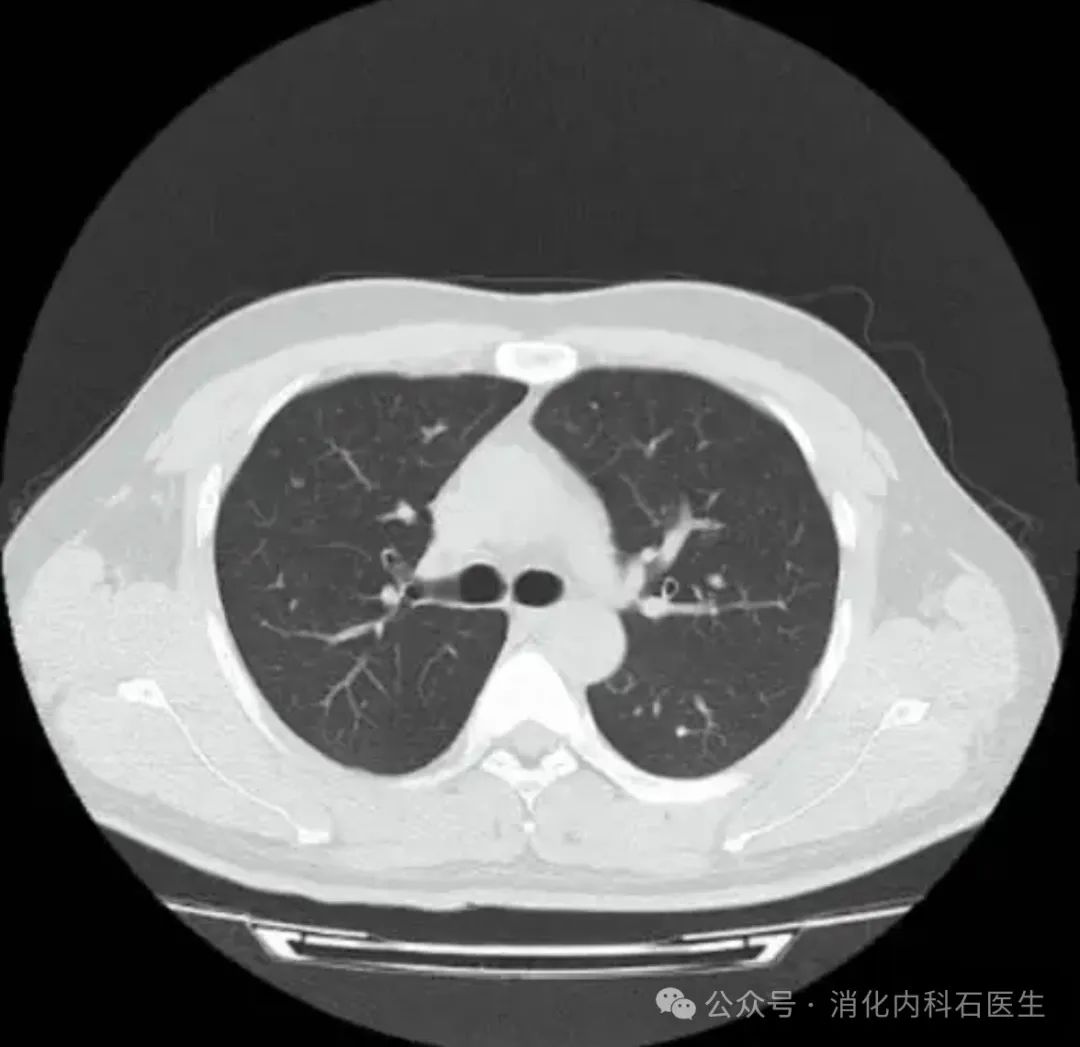 开创医学影像新纪元的早期CT技术革新