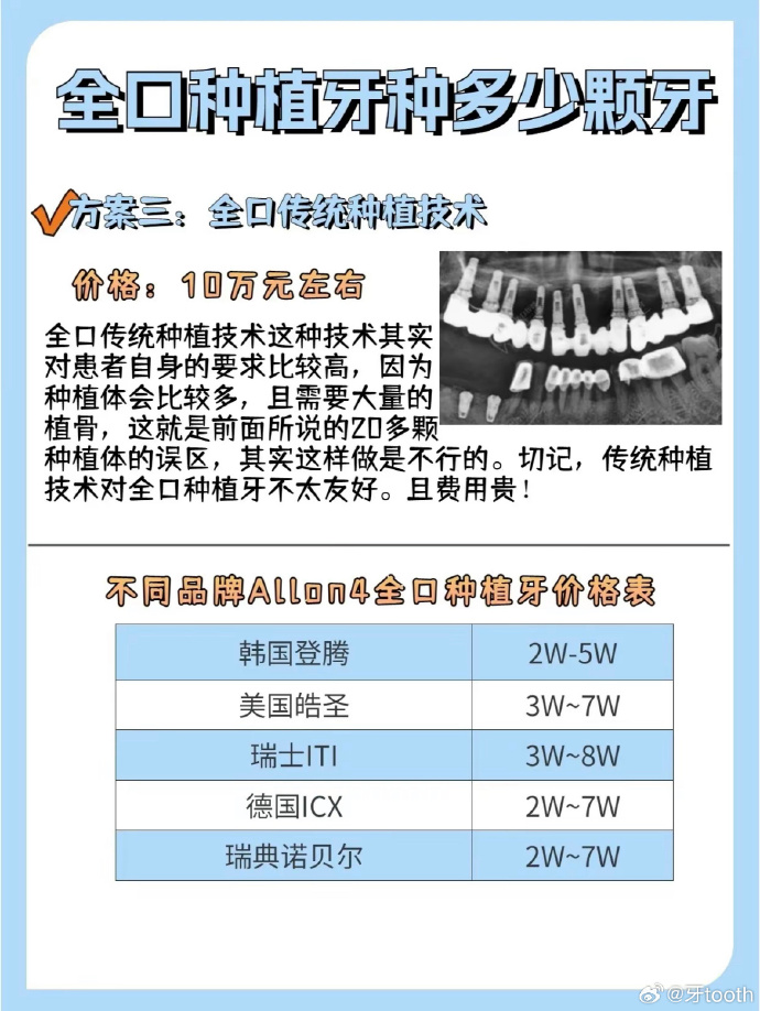 广州种牙早期价格及其历史变迁回顾